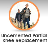 Uncemented partial knee replacement - Edwin P. Su, MD - Orthopaedic Surgeon