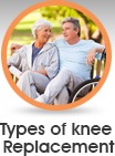 Types of Knee Replacement - Edwin P. Su, MD - Orthopaedic Surgeon