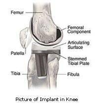 knee joint