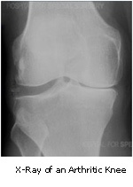 knee joint