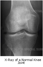 knee joint